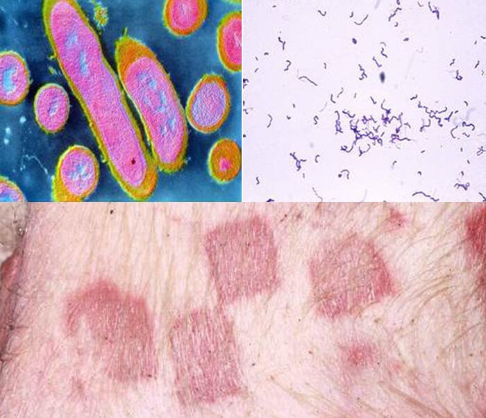 Bệnh đóng dấu lợn (Swine Erysipelas) - Tập đoàn Đức Hạnh Marphavet BMG - XEVIP.ICU