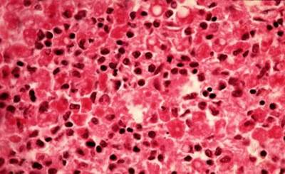 Bệnh dịch tả lợn (Classica swine Fever, Hog Cholera Suis) - Tập đoàn Đức Hạnh Marphavet BMG - XEVIP.ICU