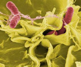 Bệnh phó thương hàn lợn (Samonellosis) - Tập đoàn Đức Hạnh Marphavet BMG - XEVIP.ICU