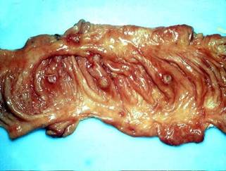 Bệnh dịch tả lợn (Classica swine Fever, Hog Cholera Suis) - Tập đoàn Đức Hạnh Marphavet BMG - XEVIP.ICU